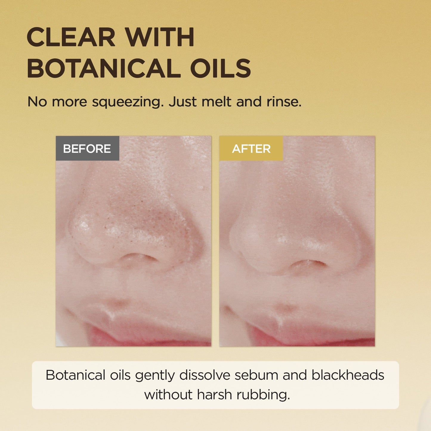 SKIN1004 Cleanser [AMAZON] Centella Light Cleansing Oil