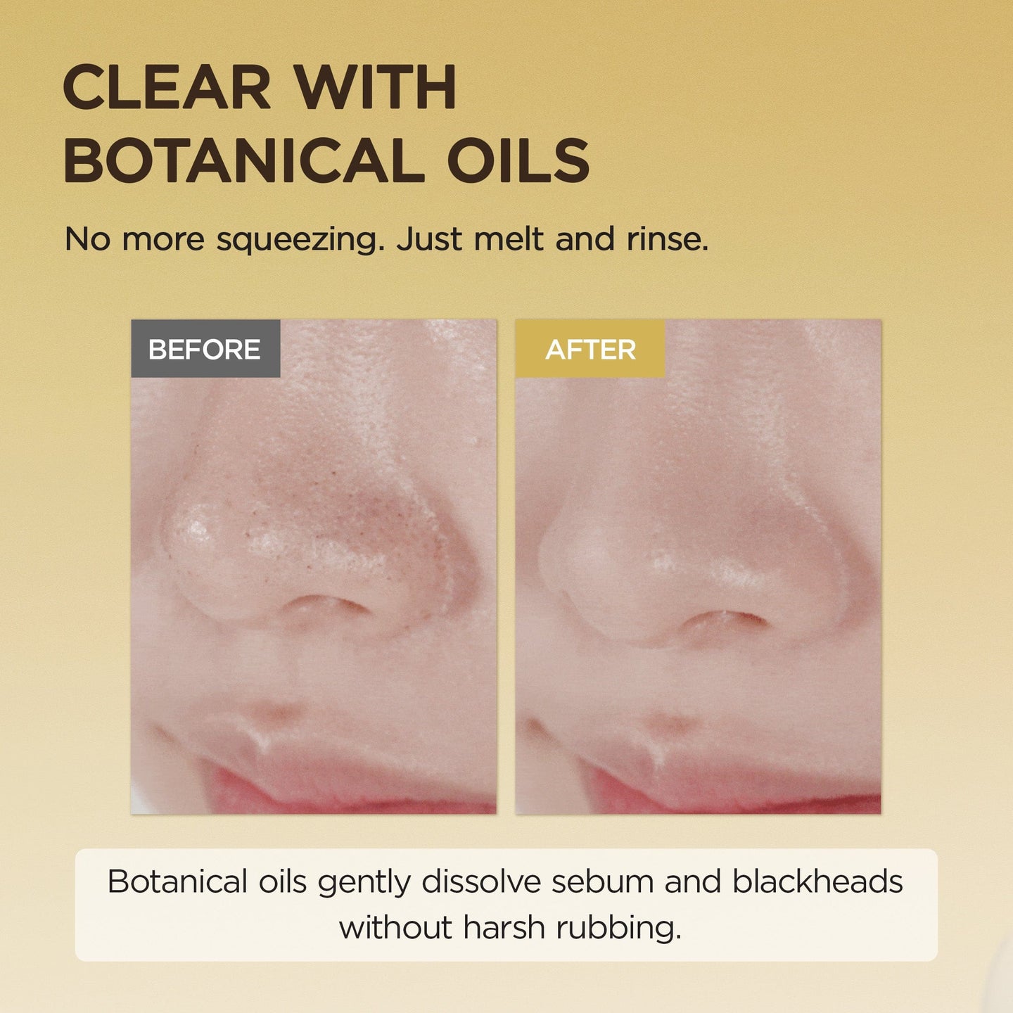 SKIN1004 Cleanser [AMAZON] Centella Light Cleansing Oil